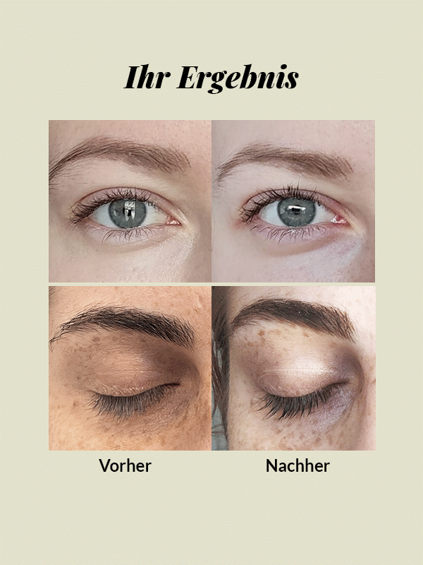 Vorher nachher Vergleich für Serum